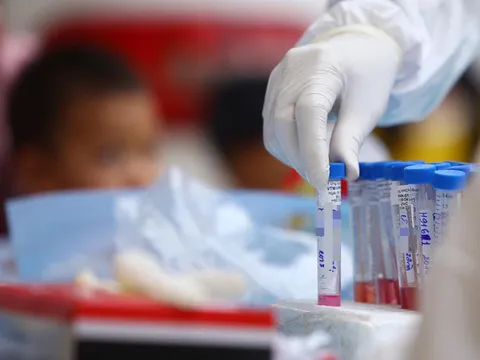 Việt Nam cán mốc 1 triệu xét nghiệm Covid-19 bằng phươg pháp PCR